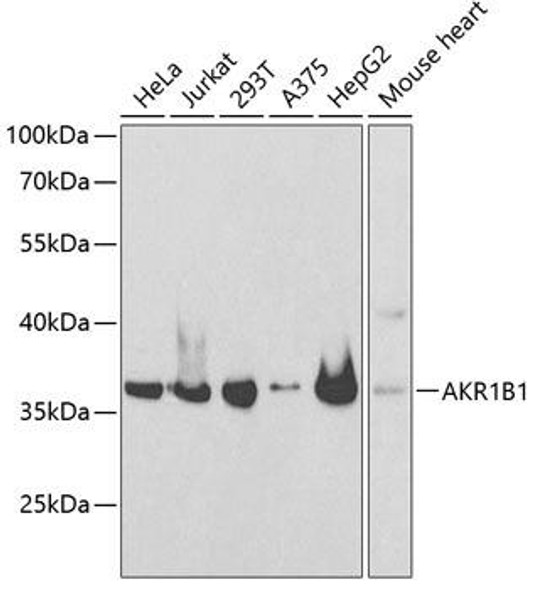 Cell Biology Antibodies 4 Anti-AKR1B1 Antibody CAB13944