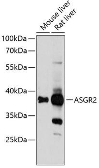 Cell Biology Antibodies 4 Anti-ASGR2 Antibody CAB13949