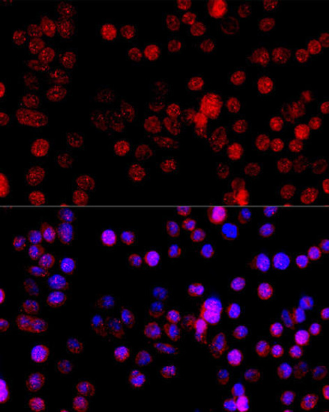 Metabolism Antibodies 1 Anti-CYP1B1 Antibody CAB13967