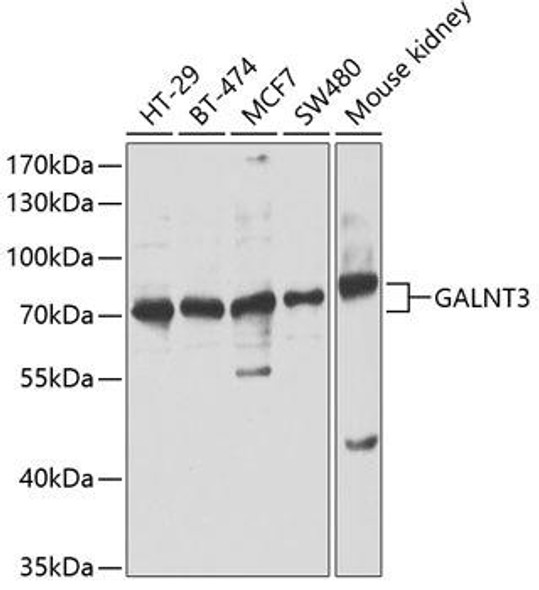 Cell Biology Antibodies 4 Anti-GALNT3 Antibody CAB13985