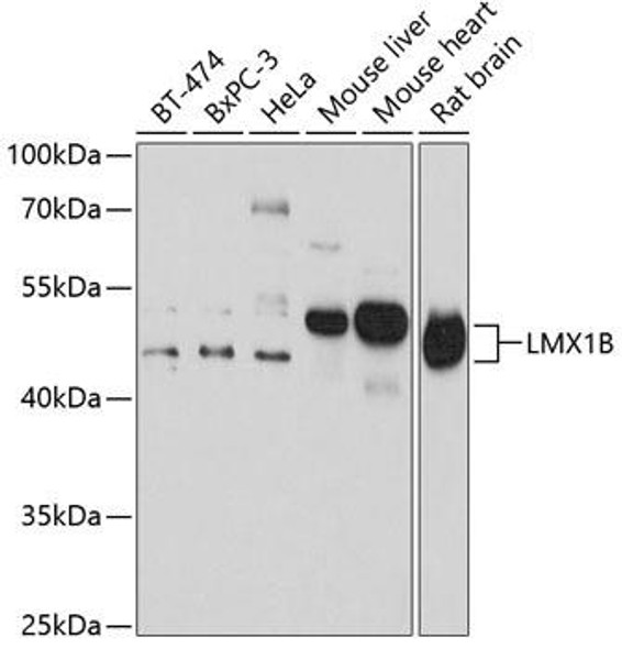 Epigenetics and Nuclear Signaling Antibodies 3 Anti-LMX1B Antibody CAB14021