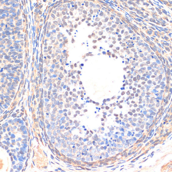 Epigenetics and Nuclear Signaling Antibodies 3 Anti-Smad5 Antibody CAB14023