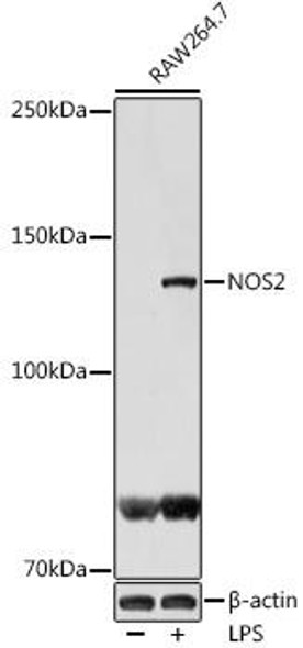 Cell Biology Antibodies 4 Anti-NOS2 Antibody CAB14031
