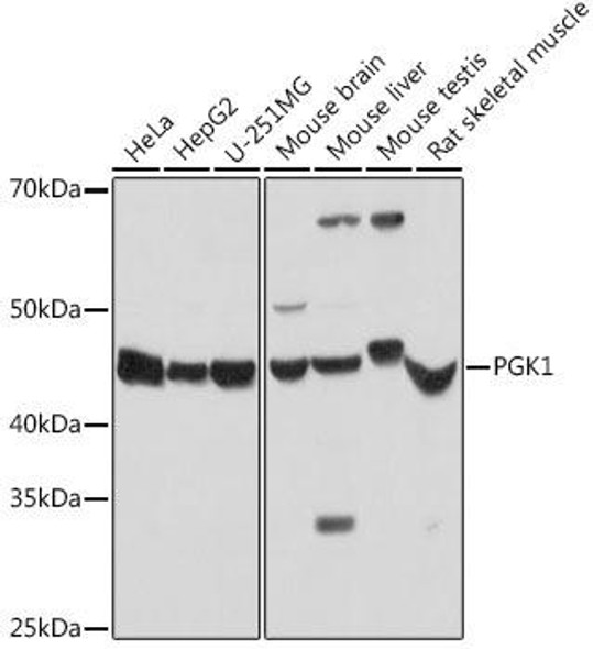 Metabolism Antibodies 1 Anti-PGK1 Antibody CAB14039