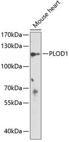 Cell Biology Antibodies 4 Anti-PLOD1 Antibody CAB14044