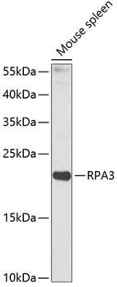 Epigenetics and Nuclear Signaling Antibodies 3 Anti-RPA3 Antibody CAB14058