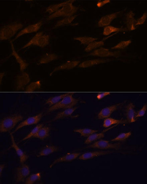 Cell Biology Antibodies 4 Anti-RPL7A Antibody CAB14060