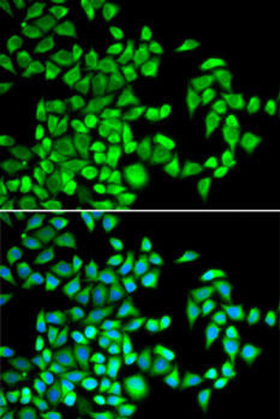 Epigenetics and Nuclear Signaling Antibodies 3 Anti-ALKBH1 Antibody CAB14079