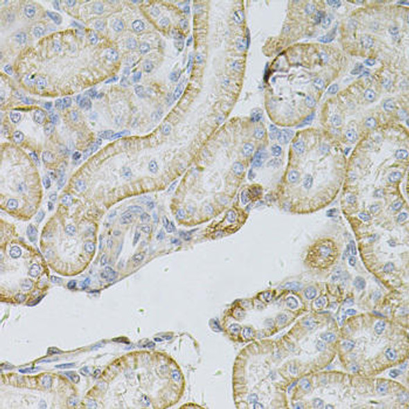Cell Biology Antibodies 4 Anti-MSLN Antibody CAB14099
