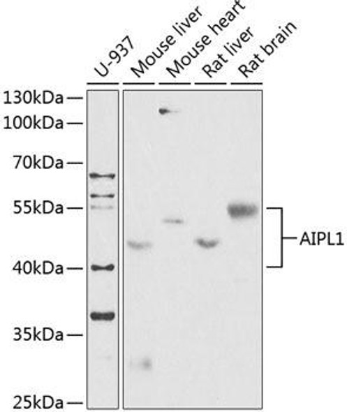 Signal Transduction Antibodies 1 Anti-AIPL1 Antibody CAB14113