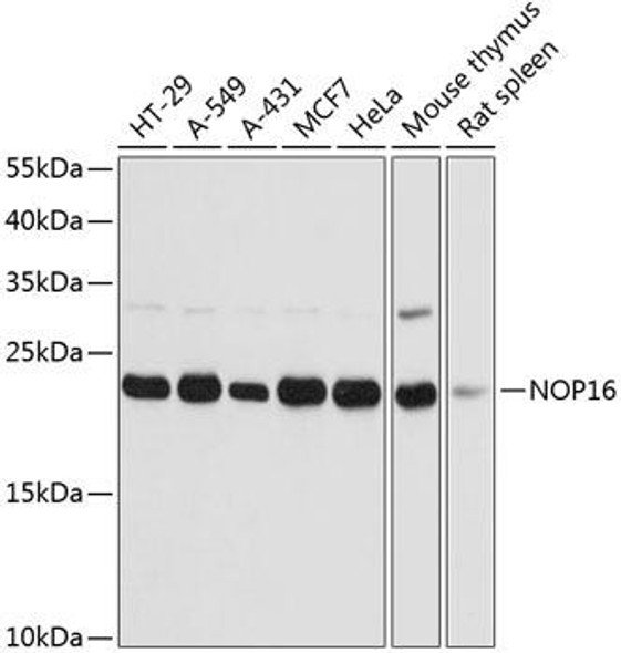 Cell Biology Antibodies 4 Anti-NOP16 Antibody CAB14128