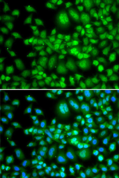 Epigenetics and Nuclear Signaling Antibodies 3 Anti-SETD5 Antibody CAB14140