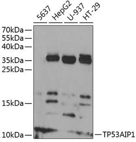 Cell Death Antibodies 1 Anti-TP53AIP1 Antibody CAB14146