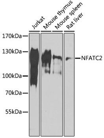 Epigenetics and Nuclear Signaling Antibodies 3 Anti-NFATC2 Antibody CAB14189