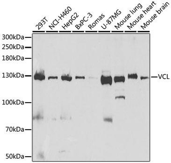 Cell Biology Antibodies 4 Anti-VCL Antibody CAB14193