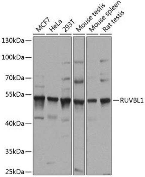 Cell Cycle Antibodies 1 Anti-RUVBL1 Antibody CAB14195