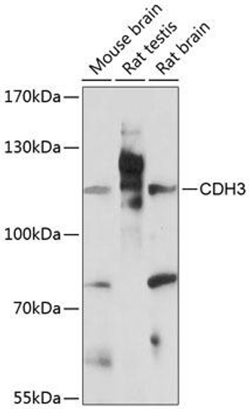 Cell Biology Antibodies 4 Anti-CDH3 Antibody CAB14235