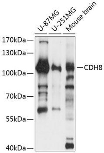 Cell Biology Antibodies 4 Anti-CDH8 Antibody CAB14236