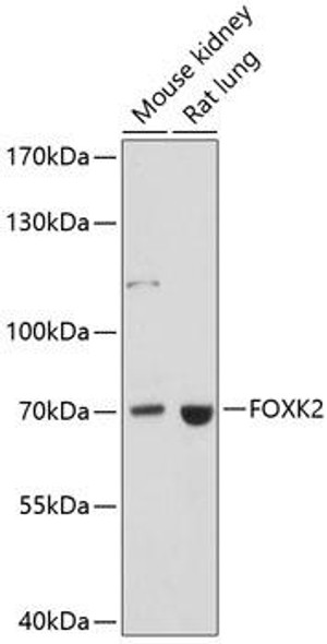 Epigenetics and Nuclear Signaling Antibodies 3 Anti-FOXK2 Antibody CAB14245