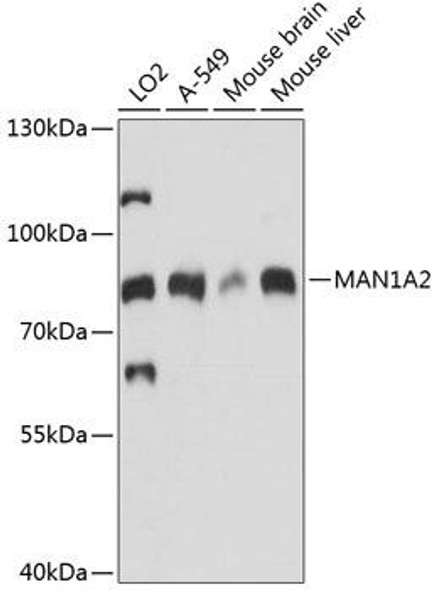 Cell Biology Antibodies 4 Anti-MAN1A2 Antibody CAB14271