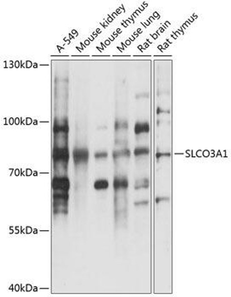 Signal Transduction Antibodies 1 Anti-SLCO3A1 Antibody CAB14276