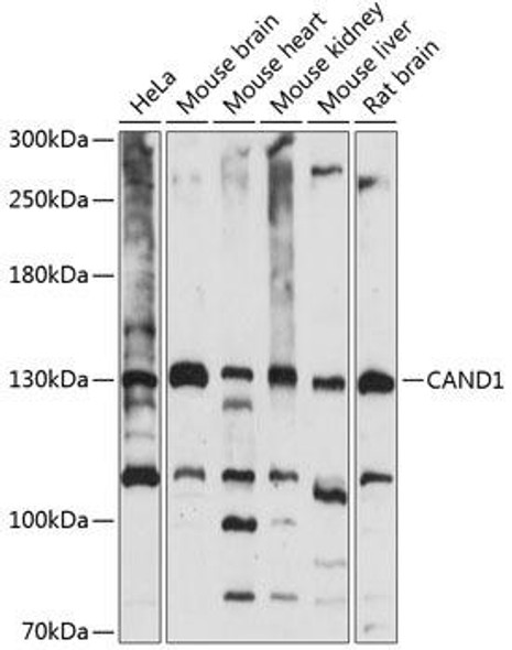 Signal Transduction Antibodies 1 Anti-CAND1 Antibody CAB14287