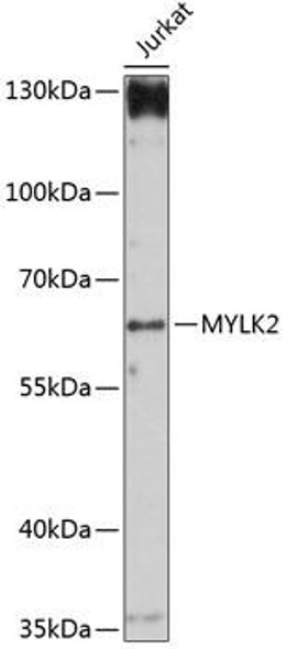 Cell Biology Antibodies 4 Anti-MYLK2 Antibody CAB14295