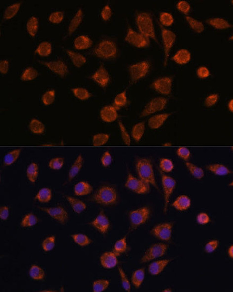 Cell Biology Antibodies 4 Anti-NDUFAF2 Antibody CAB14296