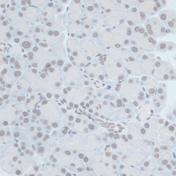 Epigenetics and Nuclear Signaling Antibodies 3 Anti-ZNF703 Antibody CAB14325