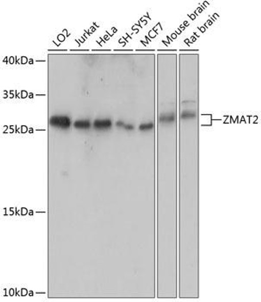 Epigenetics and Nuclear Signaling Antibodies 3 Anti-ZMAT2 Antibody CAB14354