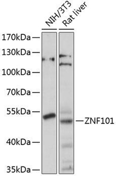 Epigenetics and Nuclear Signaling Antibodies 3 Anti-ZNF101 Antibody CAB14356