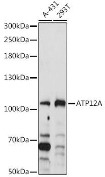 Signal Transduction Antibodies 1 Anti-ATP12A Antibody CAB14372