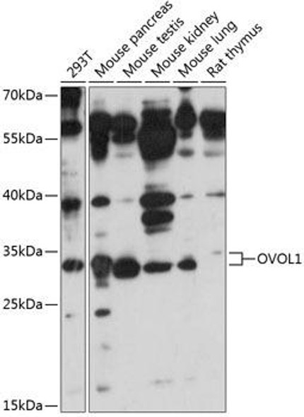 Epigenetics and Nuclear Signaling Antibodies 3 Anti-OVOL1 Antibody CAB14379