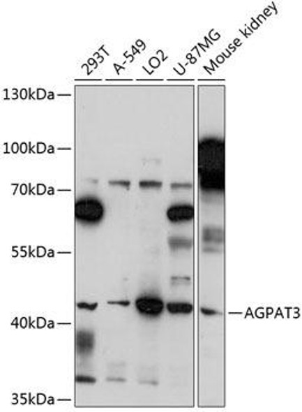 Metabolism Antibodies 1 Anti-AGPAT3 Antibody CAB14412