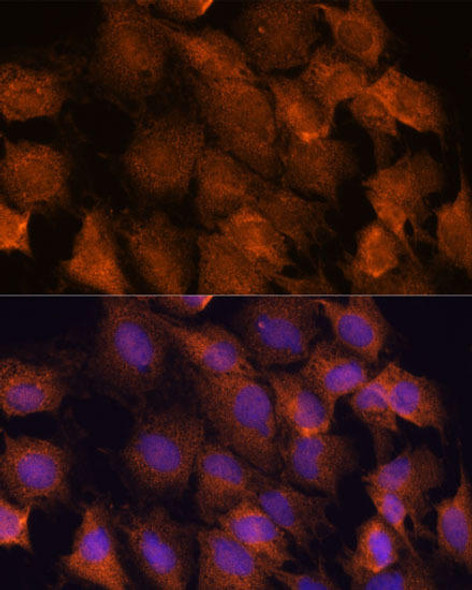 Cell Biology Antibodies 5 Anti-SCRN3 Antibody CAB14421