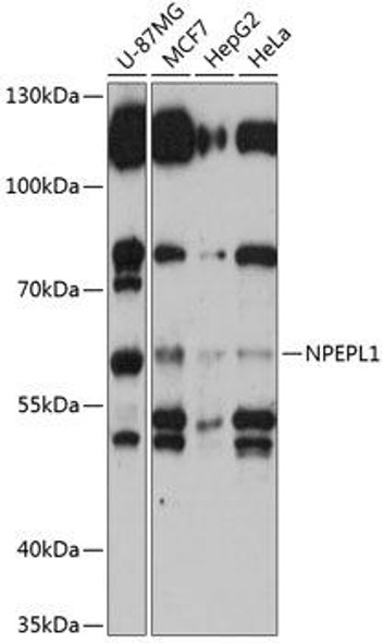 Cell Biology Antibodies 5 Anti-NPEPL1 Antibody CAB14423