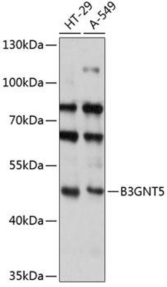 Cell Biology Antibodies 5 Anti-B3GNT5 Antibody CAB14428