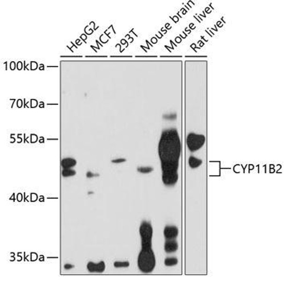 Metabolism Antibodies 1 Anti-CYP11B2 Antibody CAB1443