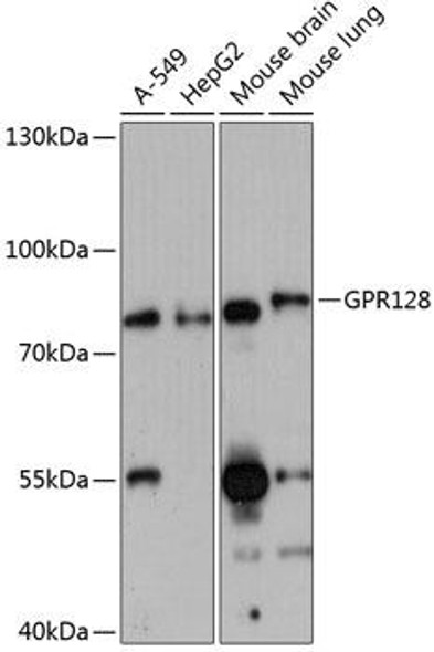 Cell Biology Antibodies 5 Anti-GPR128 Antibody CAB14431