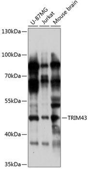 Epigenetics and Nuclear Signaling Antibodies 3 Anti-TRIM43 Antibody CAB14444