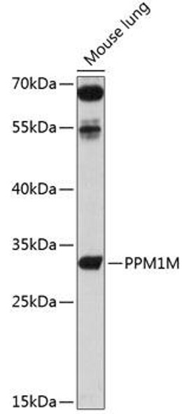Signal Transduction Antibodies 1 Anti-PPM1M Antibody CAB14446