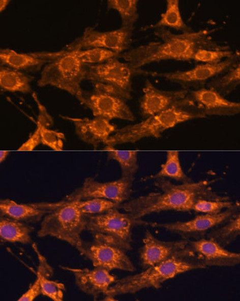 Cell Biology Antibodies 5 Anti-UBQLNL Antibody CAB14451