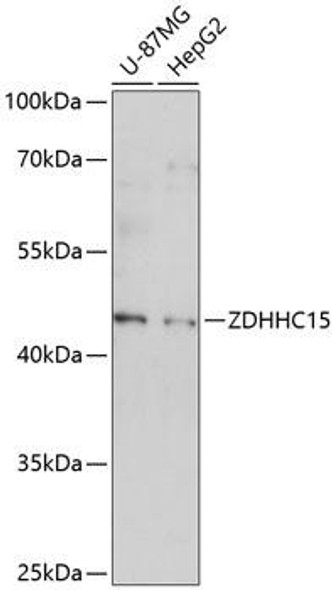 Epigenetics and Nuclear Signaling Antibodies 3 Anti-ZDHHC15 Antibody CAB14454