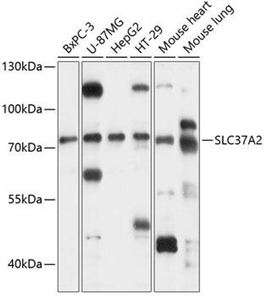 Signal Transduction Antibodies 1 Anti-SLC37A2 Antibody CAB14459