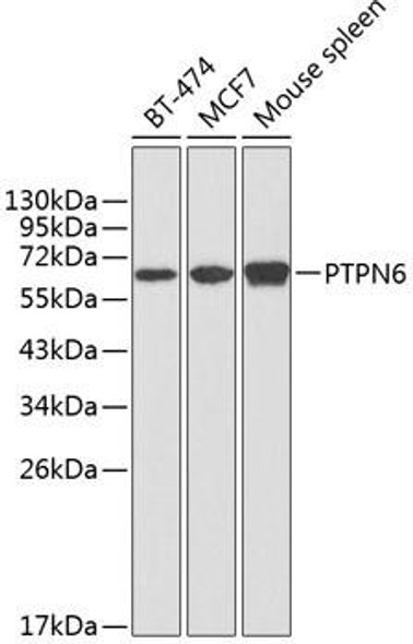 Cell Biology Antibodies 5 Anti-PTPN6 Antibody CAB1446