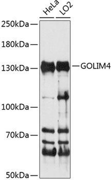 Signal Transduction Antibodies 1 Anti-GOLIM4 Antibody CAB14478