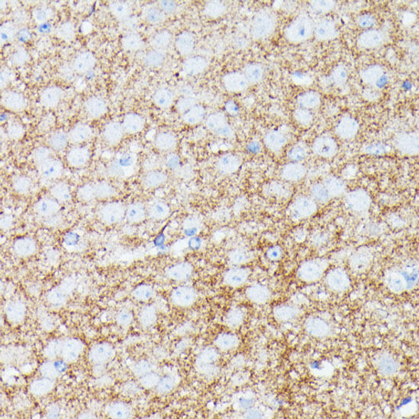 Cell Biology Antibodies 5 Anti-SNCG Antibody CAB14492