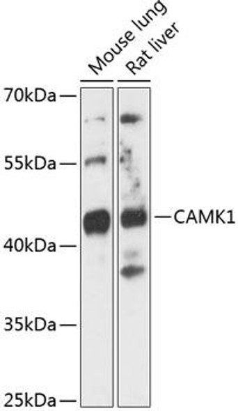 Cell Cycle Antibodies 1 Anti-CAMK1 Antibody CAB14495