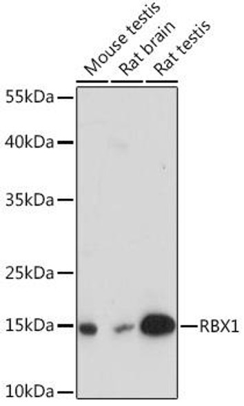 Epigenetics and Nuclear Signaling Antibodies 3 Anti-RBX1 Antibody CAB14500