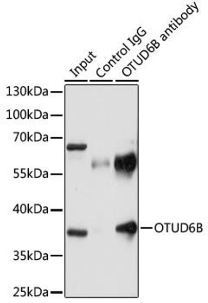 Signal Transduction Antibodies 1 Anti-OTUD6B Antibody CAB14511